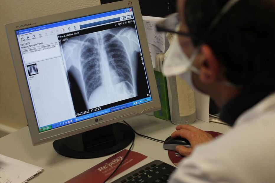 Médico pneumologista, RX, pulmões, tuberculose, hospital Pulido Valente, 