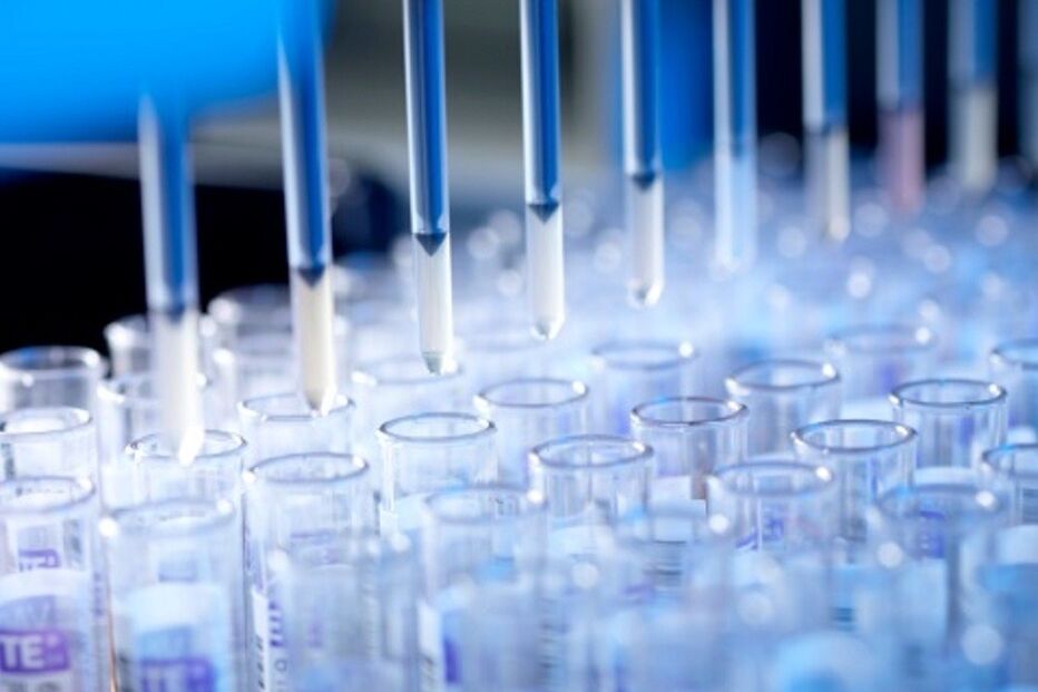 sida, vírus, teste ao sangue