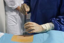 15-11-2014_21_42_33 23 hernias.jpg