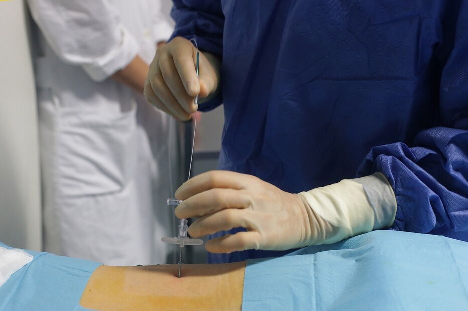 15-11-2014_21_42_33 23 hernias.jpg