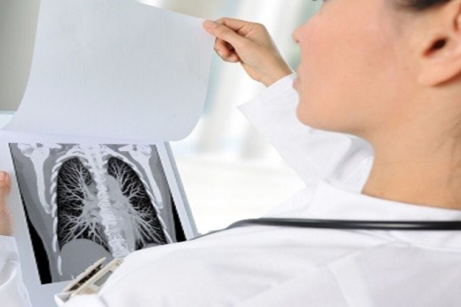 exame, pulmão