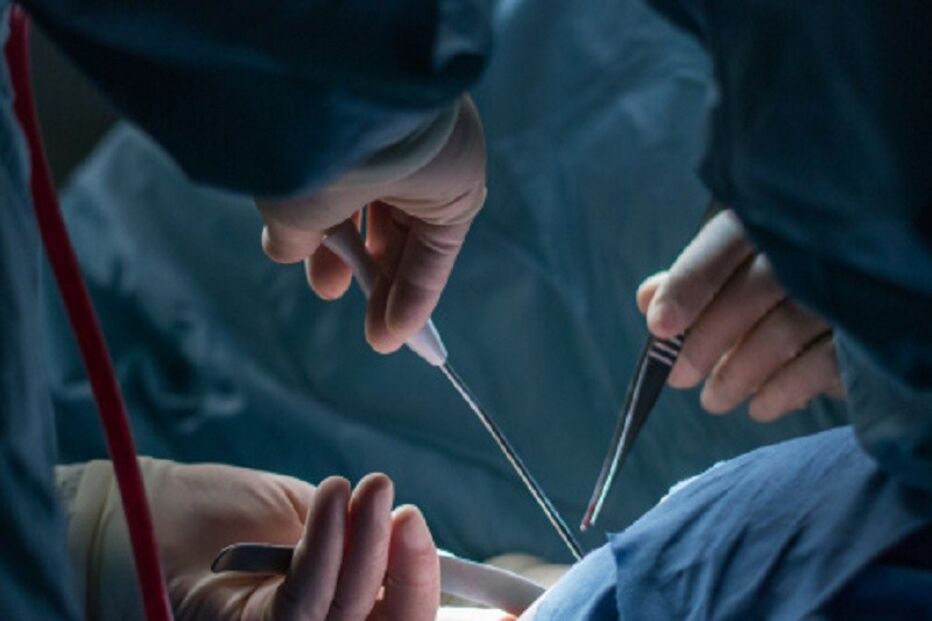 operação, médicos