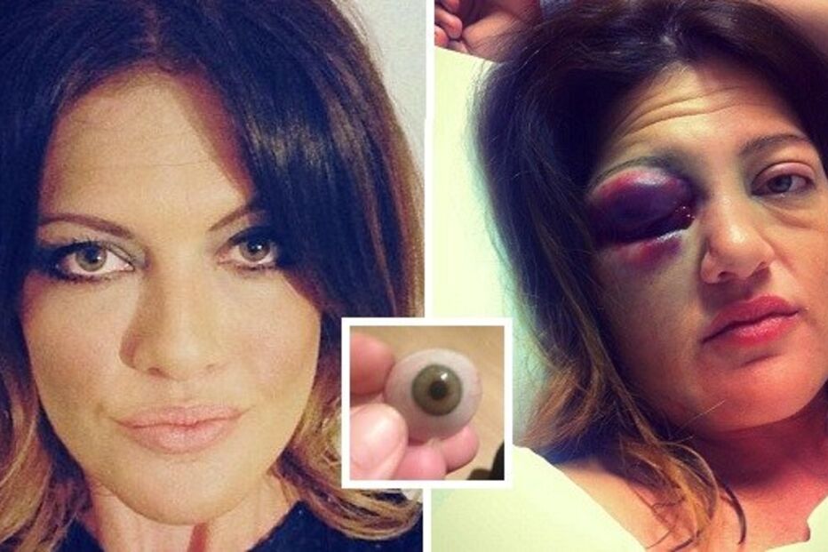 mulher, agressão, violência, doméstica, caso