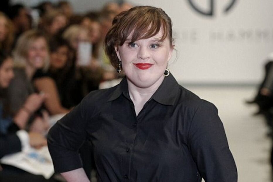 modelo, trissomia 21, doença, moda