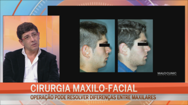 Cirurgia maxilo-facial