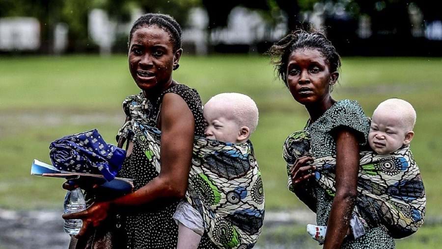 Desde 2000 já foram mortos mais de 70 albinos na Tanzânia