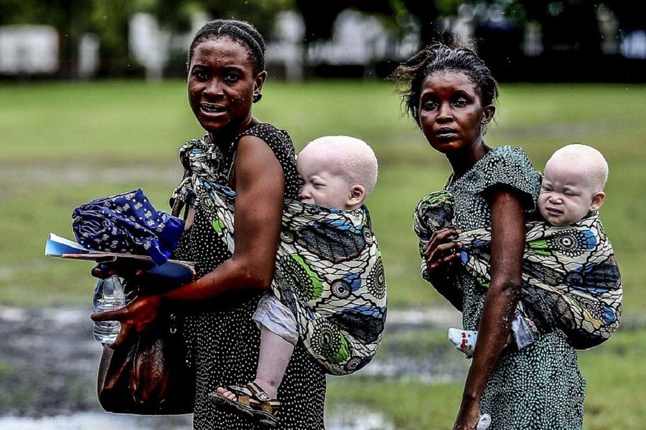 albinos, crianças, mulheres, África, Tanzânia
