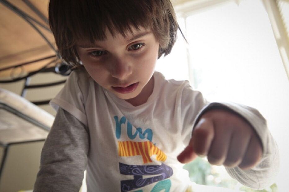 criança, Síndrome de Angelman