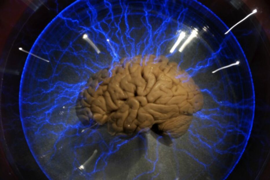 Cérebro humano