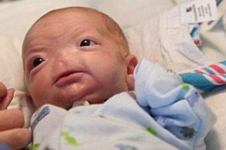 Facebook, censura, foto, bebé, rede, social