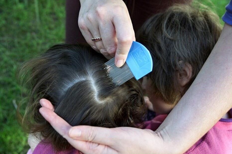 piolhos, couro cabeludo