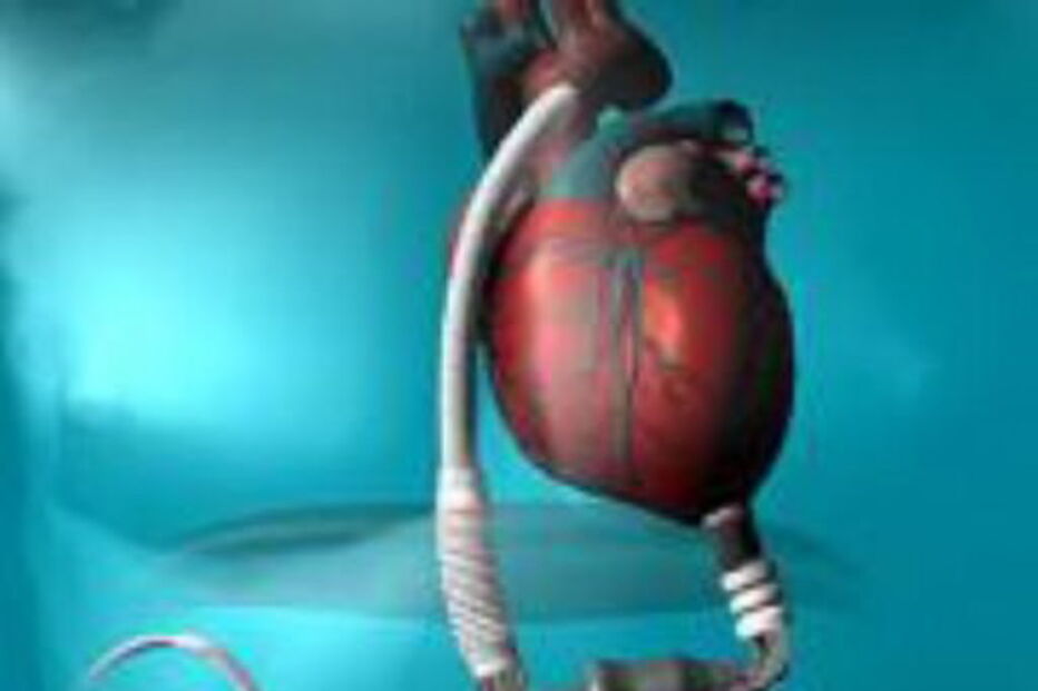 coração, artificial