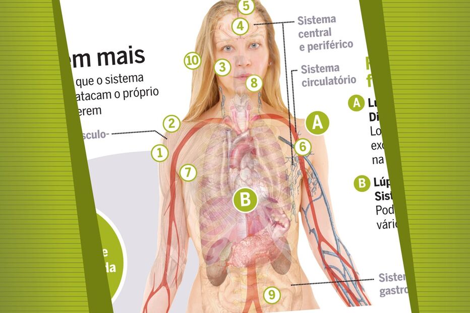 09-05-2015_23_18_36 Bolacha_SaudeLupus.jpg