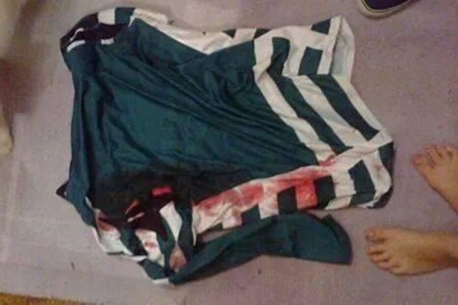 adepto, Sporting, agredido, facada, camisola, sangue, 