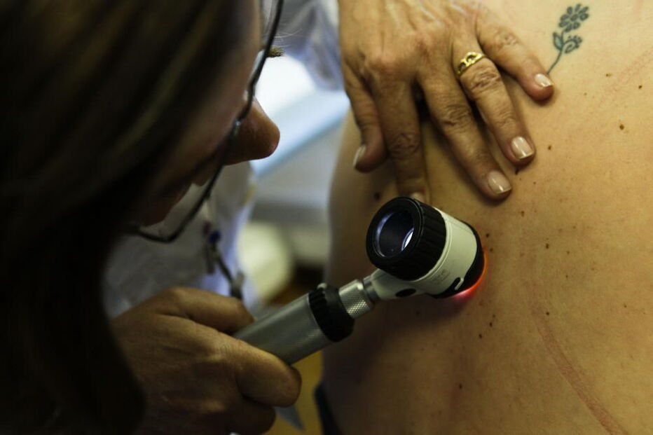 Cancro da pele