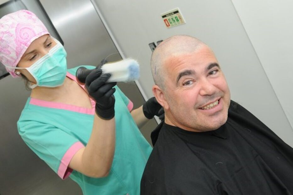 Toy, implante capilar, cabelo, estética, operação, sala de operações, calvície