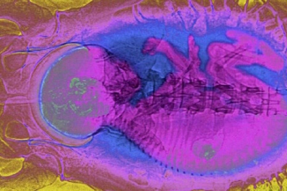 21-06-2015_23_39_10 ml feto.jpg