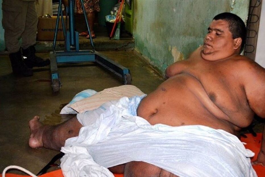 obesidade, carlinhos, brasil