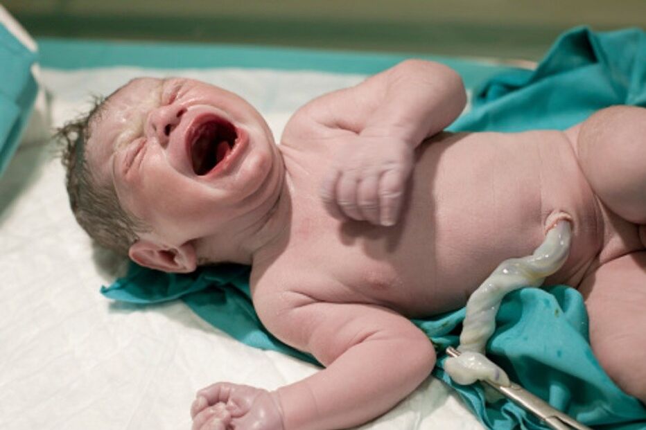 bebé, parto, nascimento