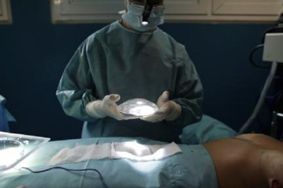 25-09-2015_03_18_42 18 silicone.jpg