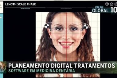 Planeamento digital de tratamentos dentários