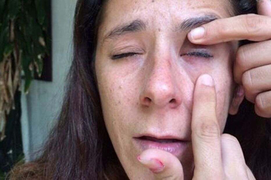 mulher, cola, olho, engano, amigo, colírio, Katherine Gaydos