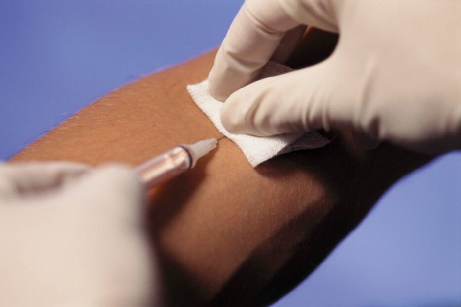 Sexo, sexo desprotegido, motorista, HIV, SIDA, indiano, Índia, Malkajgiri, polícia, assalto, relações sexuais, prostitutas, casamento