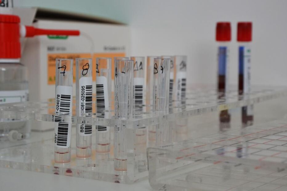 sangue, investigação