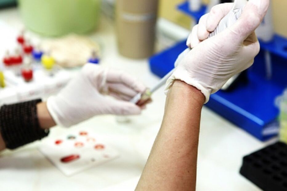 Saúde, DGS, Programa Nacional, HIV