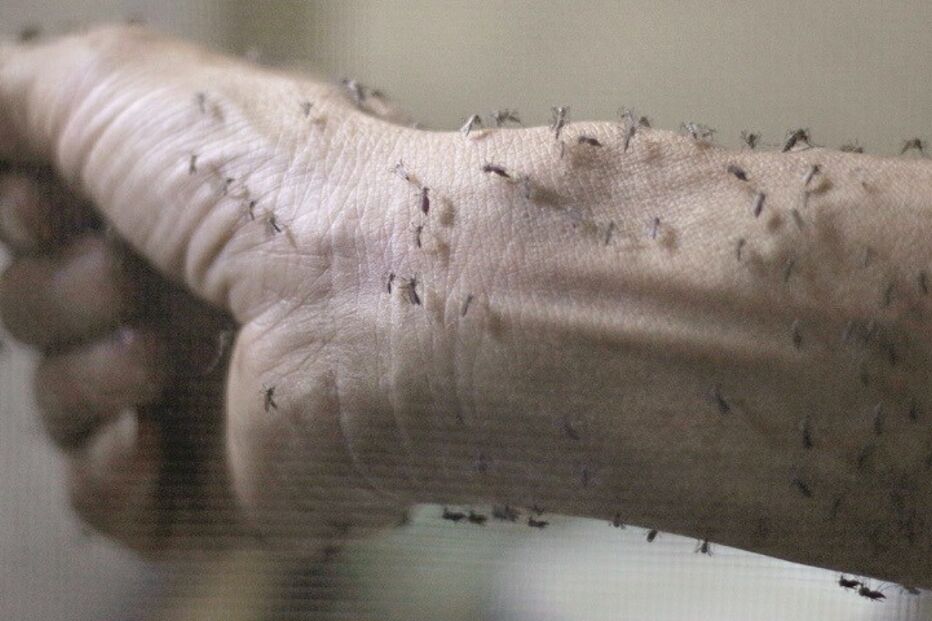 Fotorreportagem, mosquito, América, Canadá, Chile, Zika, vírus Zika, Brasil, bebés, microcefalia