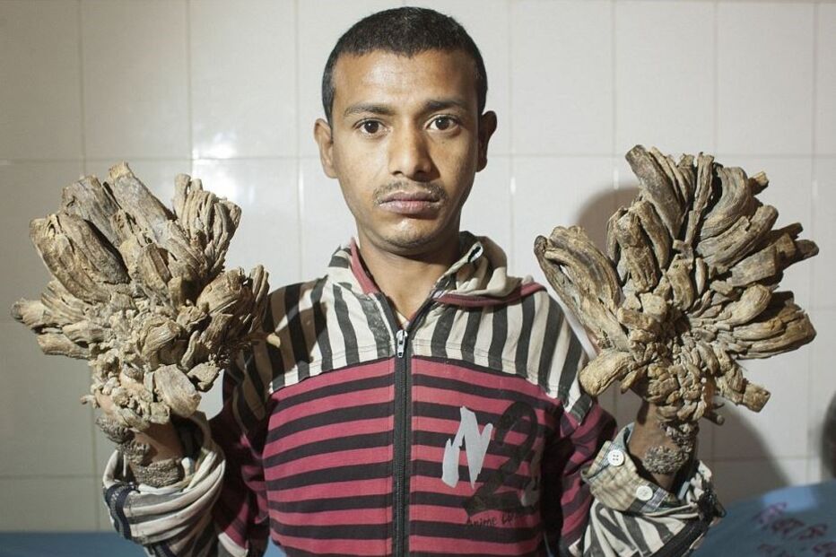 31-01-2016_22_06_35 31 ml arvore.jpg