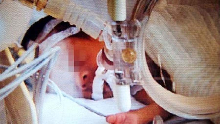 Criança entrou em paragem cardíaca após ser retirada da incubadora