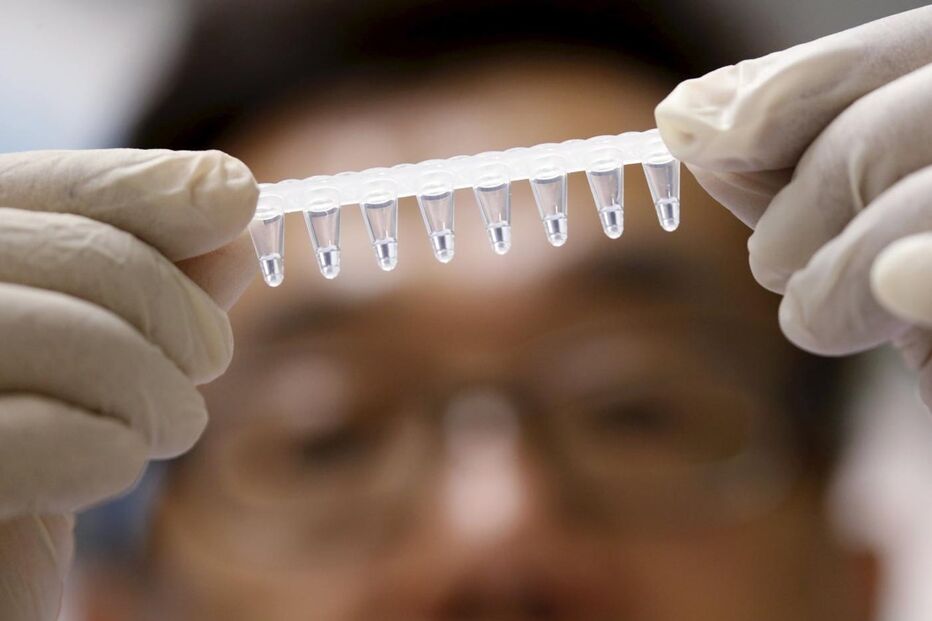 Zika, investigação