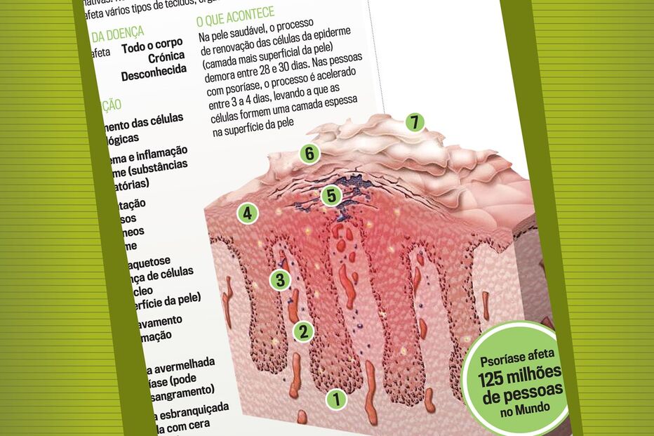 27-03-2016_02_33_56 Bolacha_Psoriase.jpg