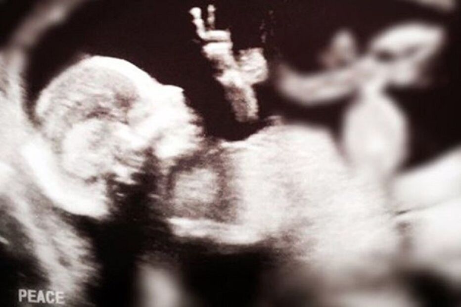 01-04-2016_10_58_48 baby.jpg