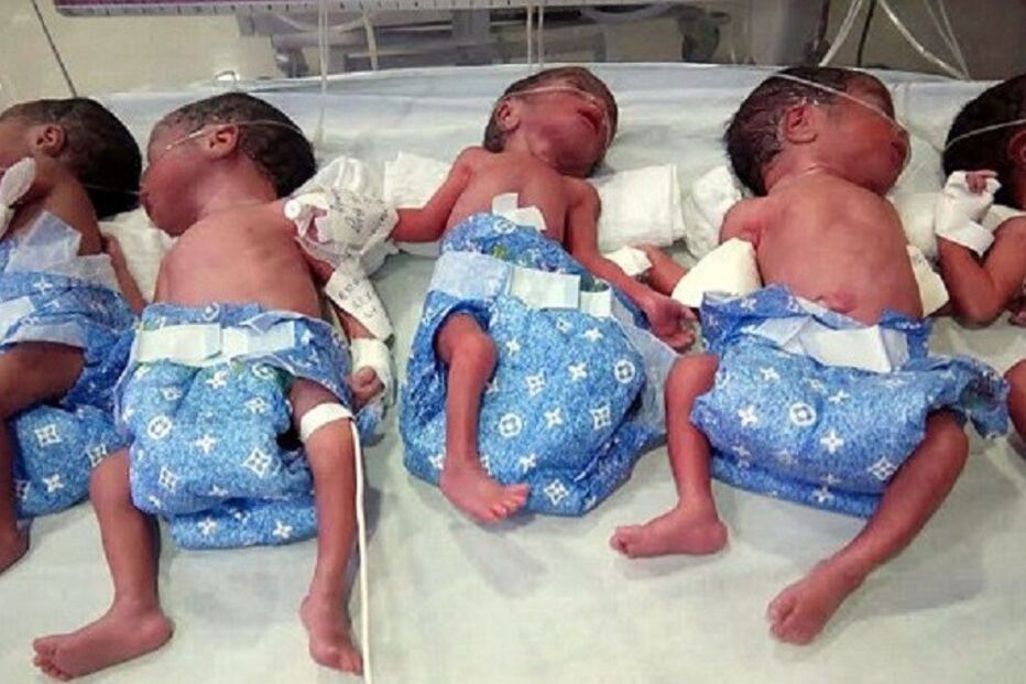 Manita Singh, hospital de Ambikapur, Índia, nascimento, parto, gémeos, insólito