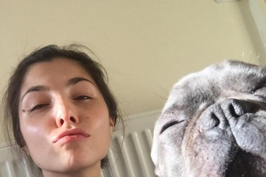 Modelo, Stina Sanders, Instagram, acne, doença intestinal