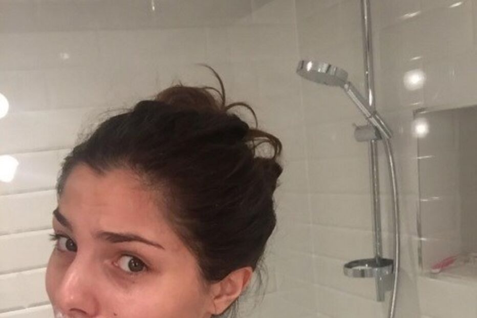 Modelo, Stina Sanders, Instagram, acne, doença intestinal