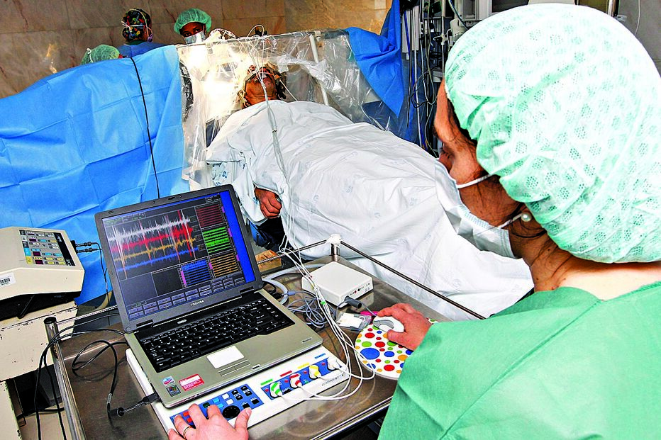 Estimulador traz melhorias a doentes de Parkinson