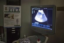 mulheres, grávidas, Brasil visita, Zika, vírus, Jogos Olímpicos, Jogos Paralímpicos