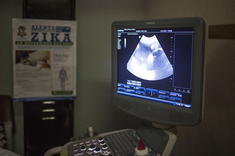 mulheres, grávidas, Brasil visita, Zika, vírus, Jogos Olímpicos, Jogos Paralímpicos