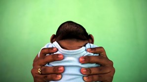 Bebé com microcefalia por Zika nasce em Espanha