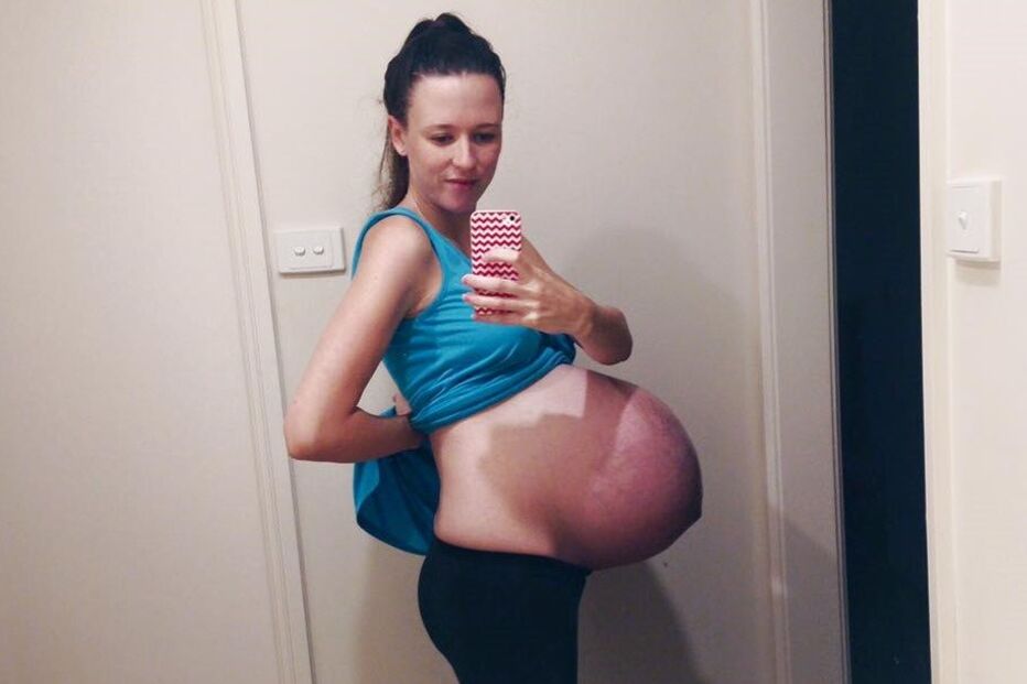 23-06-2016_10_29_08 bump.jpg