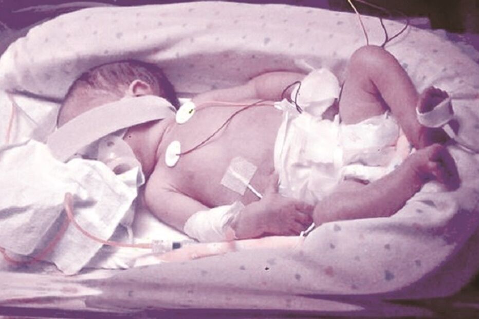 Lourenço, Miguel Ângelo, Alfredo da Costa, saúde