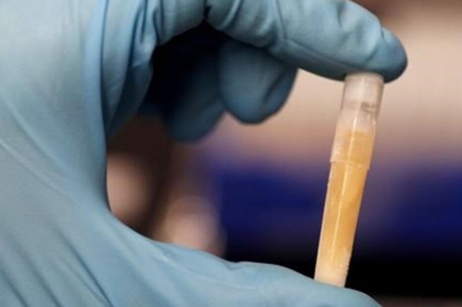 Manel Esteller, Lancet Oncology, diretor do Programa de Epigenética e Biologia, Instituto de Investigação Biomédica de Bellvitge, saúde, ciência e tecnologia, ciência e tecnologia