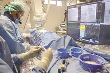 Ecografia, intracoronária, artérias, coração, sangue, cardiologia, saúde