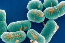 hospital da Horta, Faial, Açores, Saúde, doenças, questões sociais, doenças contagiosas, legionella