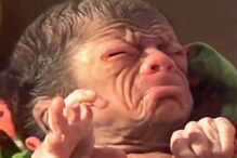 bebé, criança, Bangladesh, Benjamin Button, rugas, síndroma, Huntchinson-Gilford