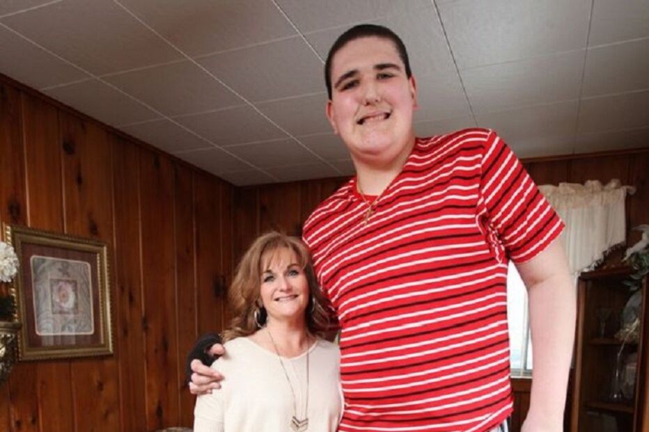 Broc Brown, Síndrome de Sotos, Doença, Jovem, Altura, Mais alto do mundo, Limitações, Norte-Americano, Patologia