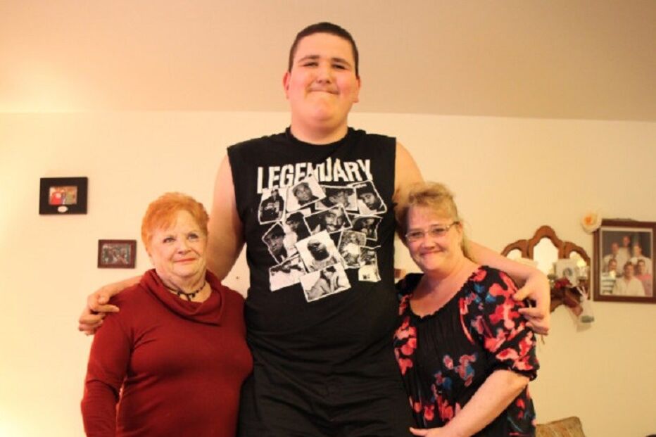 Broc Brown, Síndrome de Sotos, Doença, Jovem, Altura, Mais alto do mundo, Limitações, Norte-Americano, Patologia